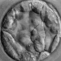 blastocyst