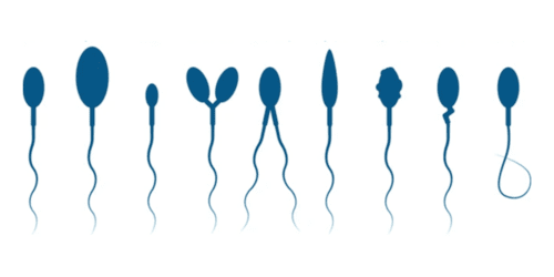 Sperm abnormalities 