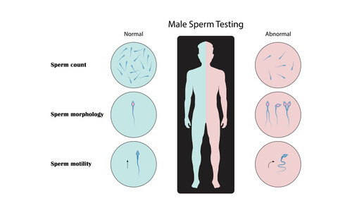 Male fertility issues 