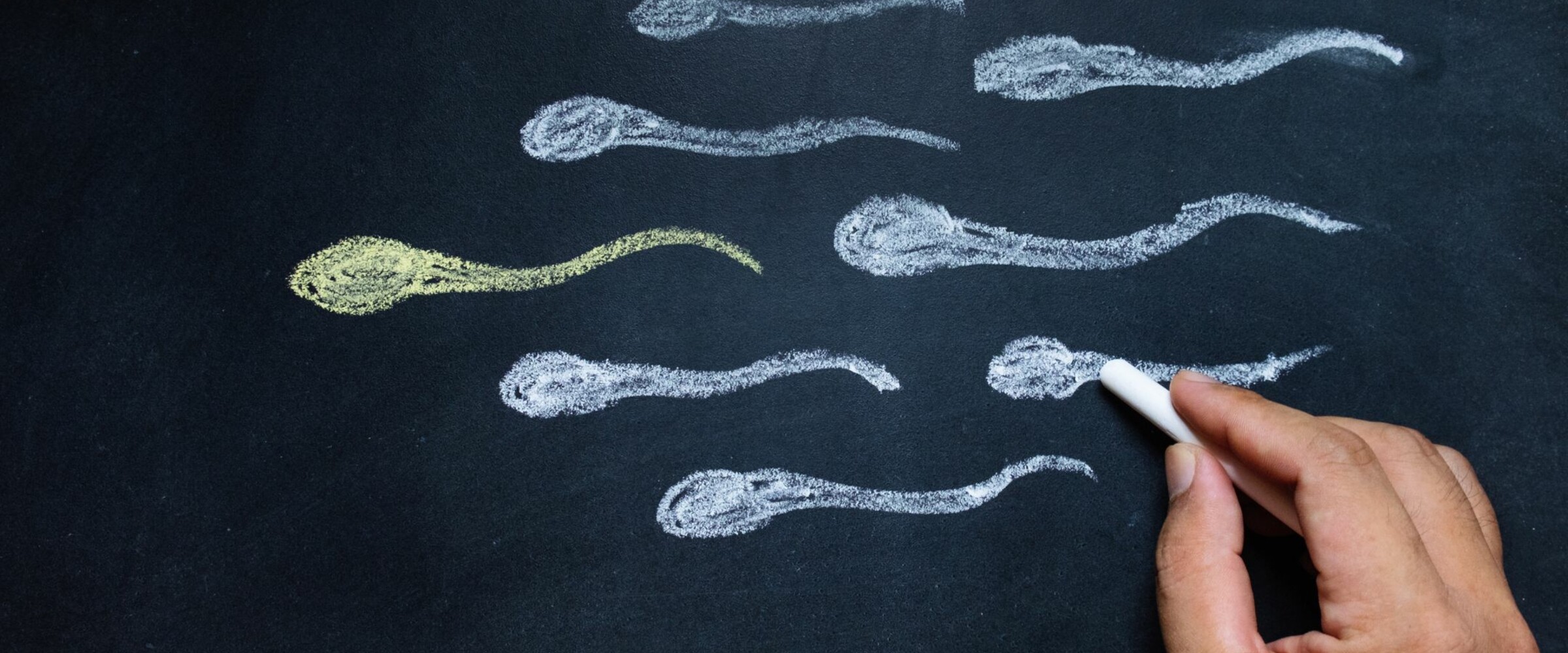 Sperm